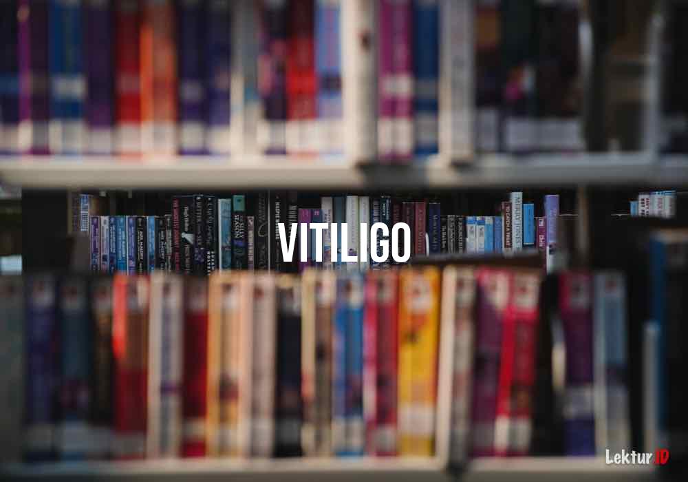 arti vitiligo